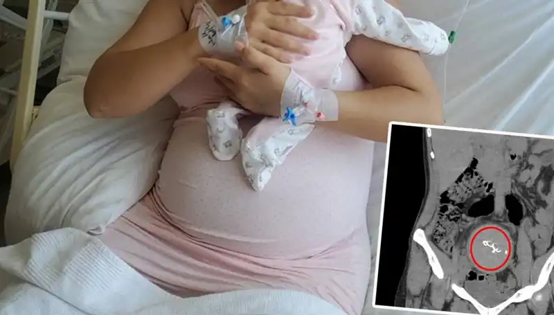 Doğumda Unutulan Bebek: İhmal Sebebiyle Gazlı Bez Soruşturması Başlatıldı